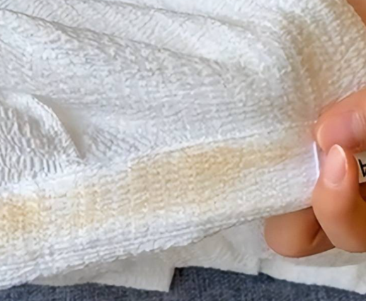 发黄的衣服能恢复吗